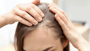 haar wird dünner was tun, immer dünnere haare, wenig haare Philomena Hair